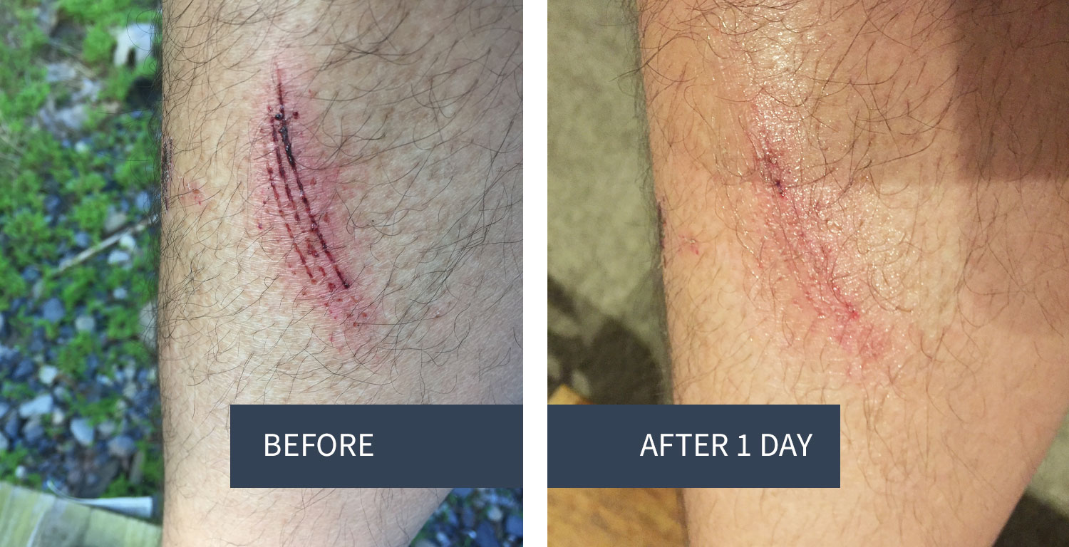 before-after-1-day Before and After using Skin Balm
